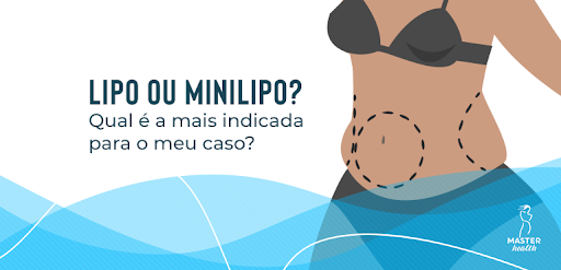 corpo feminino com destaques em forma de círculo para indicar se é melhor realizar uma lipo ou minilipo