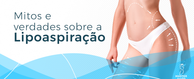 lipoaspiração mitos e verdades