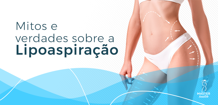lipoaspiração mitos e verdades