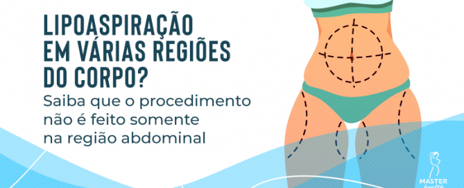 Parte do corpo feminino mostrando que é possível fazer a lipoaspiração em várias regiões do corpo