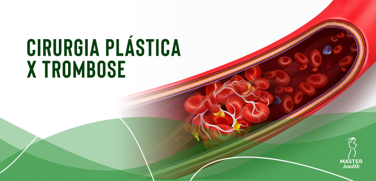 trombose em cirurgia plástica