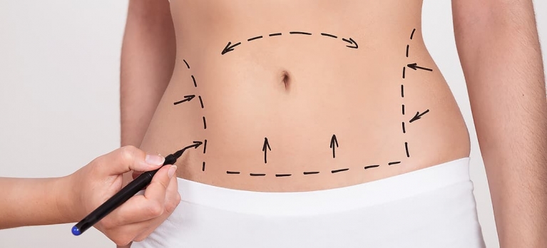 prepare-se para a sua abdominoplastia