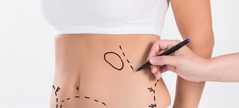 Segurança na lipoaspiração