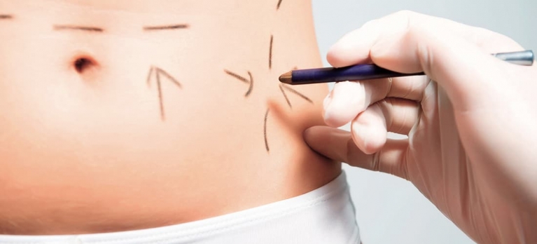saiba como identificar segurança no cirurgião que fará a sua abdominoplastia