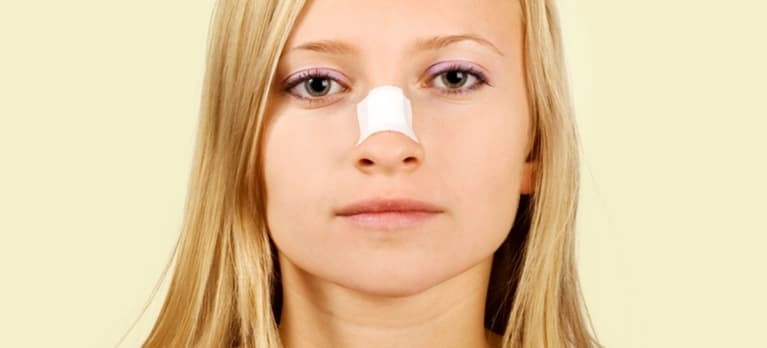 3 mitos sobre a rinoplastia