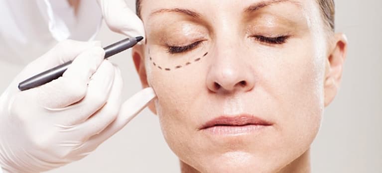 blefaroplastia a cirurgia das pálpebras