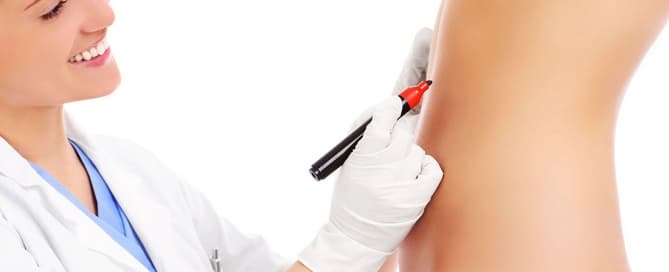 indicações da abdominoplastia