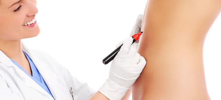 indicações da abdominoplastia