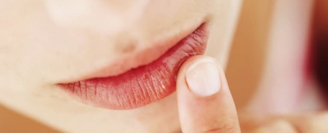 Popularidade do preenchimento labial
