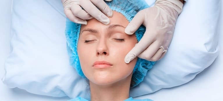 resultado depois da blefaroplastia