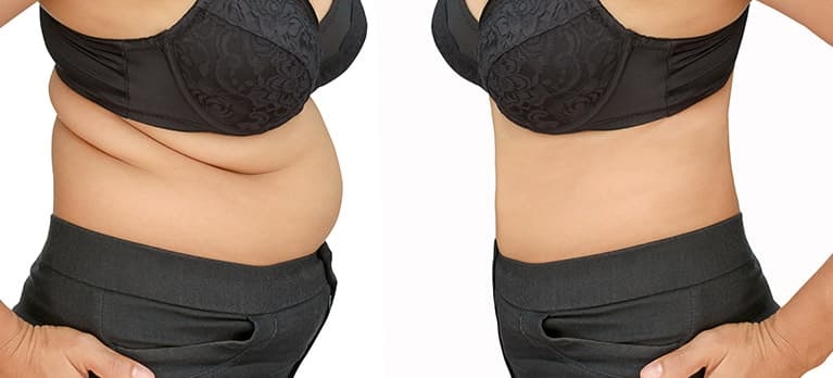 fotos de antes e depois da cirurgia plástica