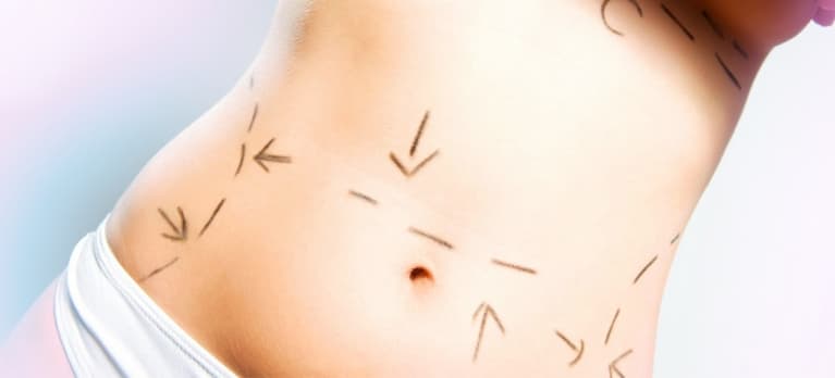 Lipoaspiração faz milagre