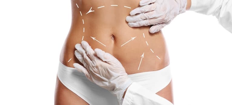 4 mitos sobre cirurgia plástica