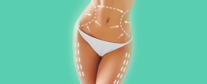 4 perguntas frequentes sobre lipoescultura