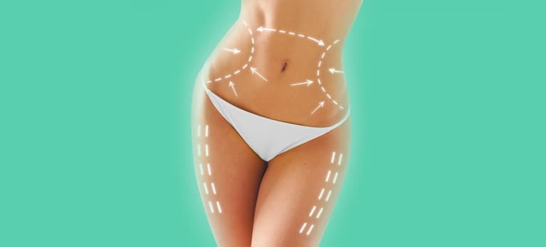 4 perguntas frequentes sobre lipoescultura