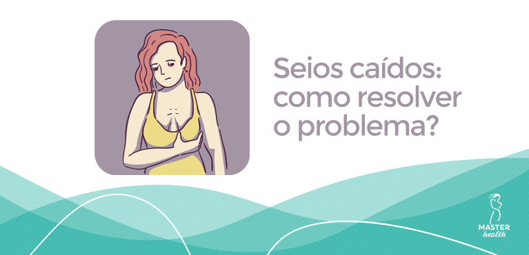 seios caídos
