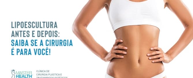 Lipoescultura antes e depois