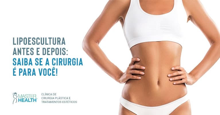 Lipoescultura antes e depois