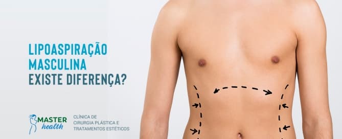 lipoaspiração masculina