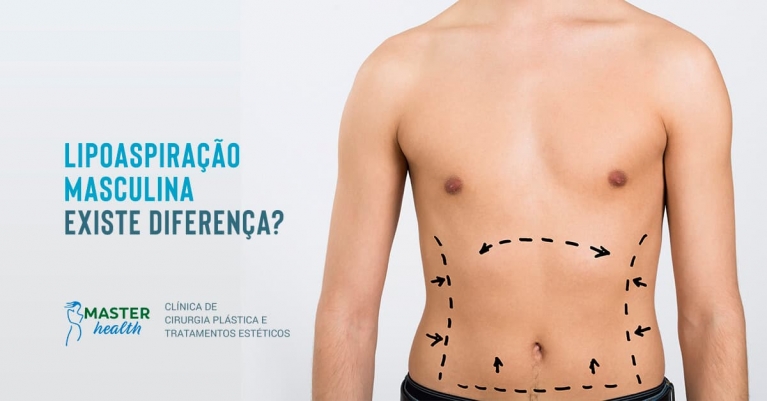 lipoaspiração masculina