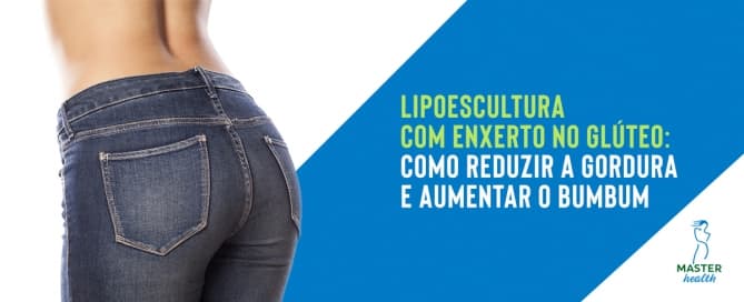 Lipoescultura com enxerto no glúteo: como reduzir a gordura e aumentar o bumbum