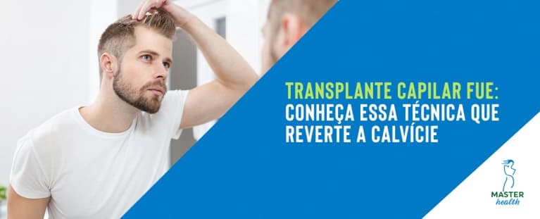 Transplante capilar FUE: conheça essa técnica que reverte a calvície