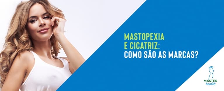 Mastopexia: Como fica a cicatriz da cirurgia que corrige a flacidez das mamas?