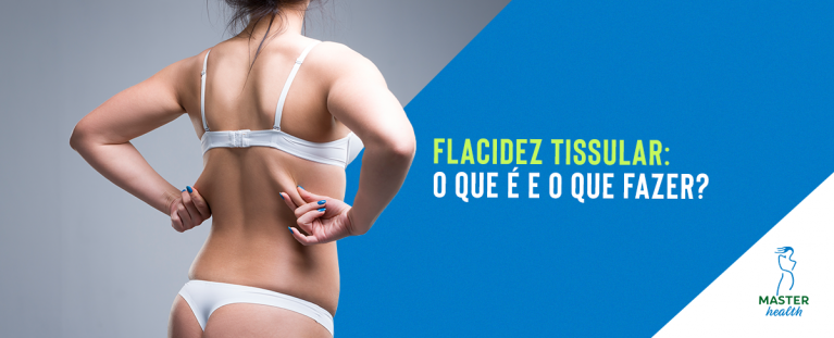 Flacidez tissular
