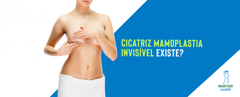 Cicatriz mamoplastia invisível