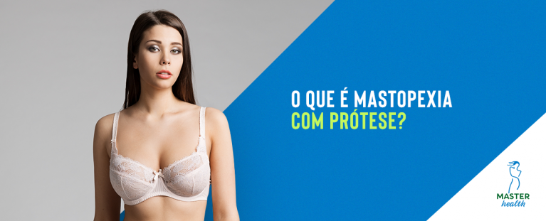 mastopexia com prótese