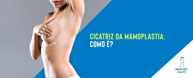 Cicatriz da mamoplastia