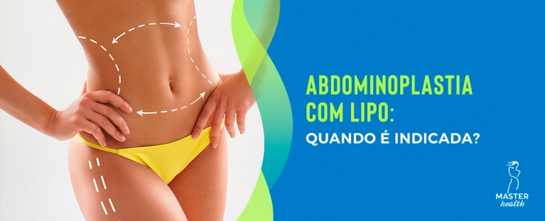 Abdominoplastia com lipo: quando é indicada?