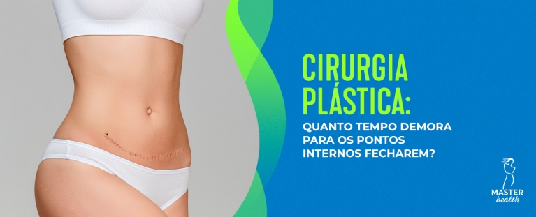 quando os pontos internos plástica começam a fechar
