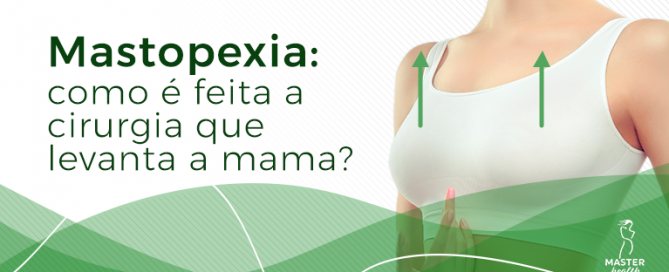 como é feita a mastopexia cirurgia que levanta a mama
