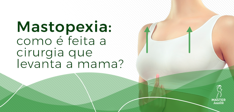 como é feita a mastopexia cirurgia que levanta a mama