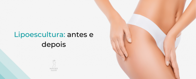 lipoescultura-01-master-health