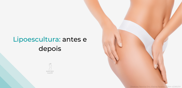 lipoescultura-01-master-health