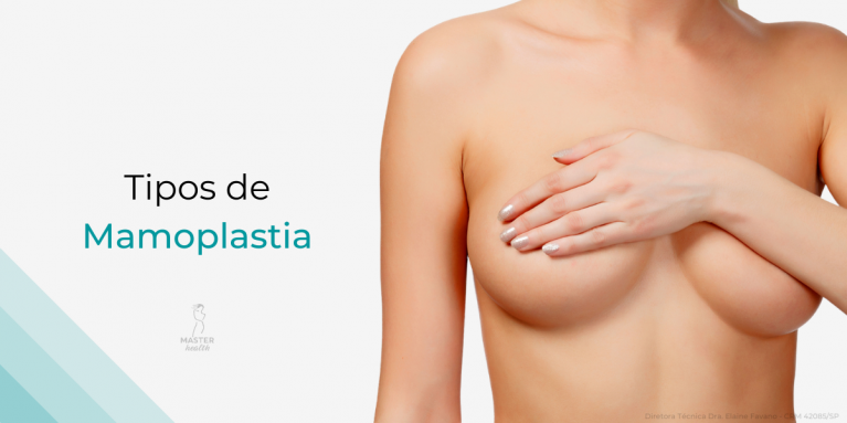 tipos-mamoplastia-03-master-health.