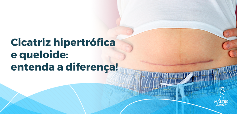 o que é cicatriz hipertrófica
