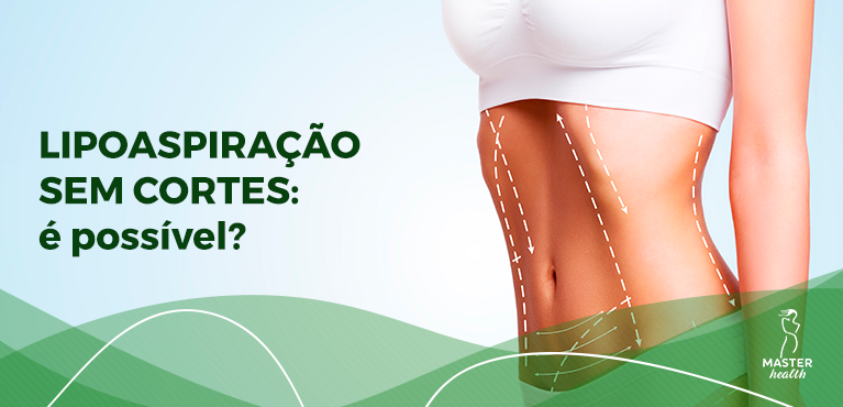 como é feita a lipo sem cortes