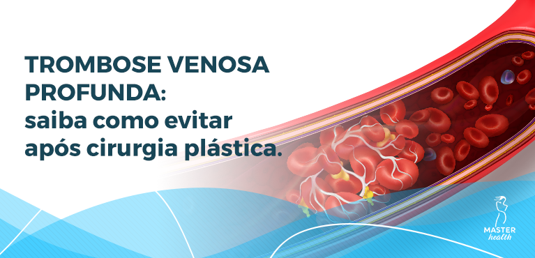 trombose venosa profunda