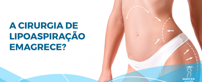 a cirurgia de lipo emagrece
