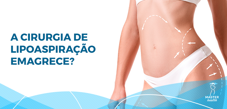 a cirurgia de lipo emagrece