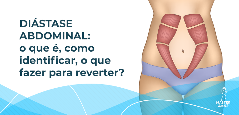 diástase