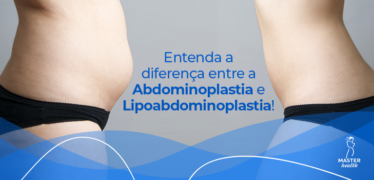 diferença entre a abdominoplastia e lipoabdominoplastia