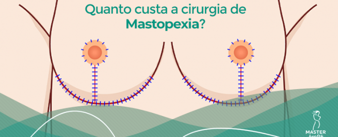 mastopexia valor