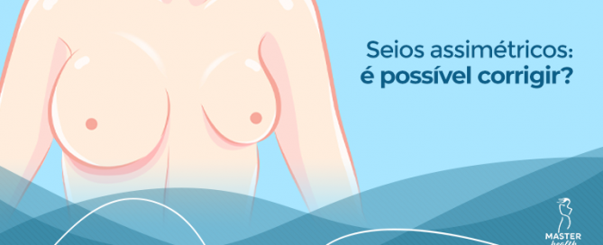 como corrigir seios assimétricos