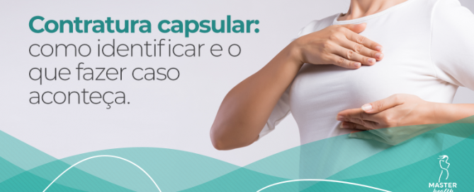 contratura capsular