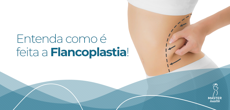 entenda o que é flancoplastia