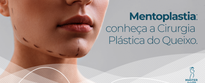 conheça a mentoplastia